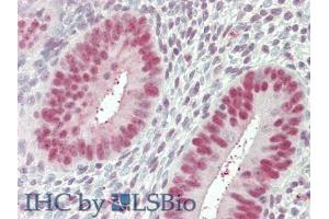 IHC-P analysis of Human Uterus Tissue, with HE staining. (Nucleolin anticorps  (AA 388-569))