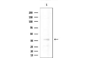 anti-Nanog Homeobox Pseudogene 8 (NANOGP8) antibody
