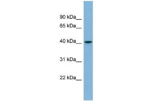 WB Suggested Anti-SERPINI1 Antibody Titration: 0. (Neuroserpin anticorps  (Middle Region))