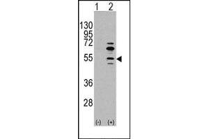 Image no. 1 for anti-Myocyte Enhancer Factor 2C (MEF2C) (Ser59) antibody (ABIN358803) (MEF2C anticorps  (Ser59))