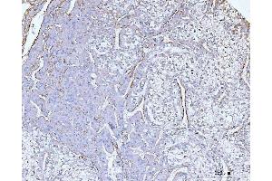 IHC analysis of Collagen VI/COL6A2 using anti-Collagen VI/COL6A2 antibody (ABIN7601439).