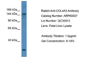 WB Suggested Anti-COL4A3  Antibody Titration: 0. (COL4a3 anticorps  (N-Term))