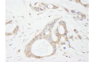 Immunohistochemistry (IHC) image for anti-Ubiquitin Specific Peptidase 5 (USP5) (AA 375-425) antibody (ABIN7449032) (USP5 anticorps  (AA 375-425))
