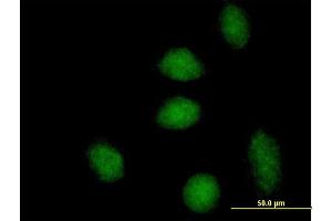Immunofluorescence of purified MaxPab antibody to DNAJB6 on HeLa cell.