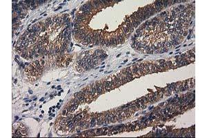 Image no. 10 for anti-Glucosidase, Beta, Acid 3 (Cytosolic) (GBA3) (AA 1-150), (AA 370-469) antibody (ABIN1490582)