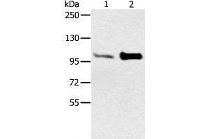 Western Blot analysis of Mouse muscle and heart tissue using ACTN2 Polyclonal Antibody at dilution of 1:300 (ACTN2 anticorps)