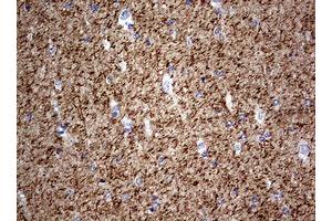 anti-Neurofilament, Light Polypeptide (NEFL) (AA 1-360) antibody