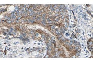 ABIN6277589 at 1/100 staining Human prostate tissue by IHC-P. (CBR1 anticorps  (C-Term))