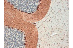 IP3 Receptor Immunohistochemistry.