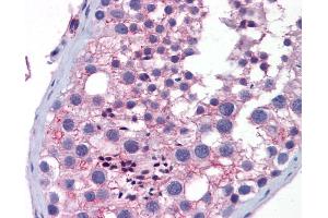 Immunohistochemistry (IHC) image for anti-Wingless-Type MMTV Integration Site Family, Member 10A (WNT10A) (Middle Region) antibody (ABIN2776724)