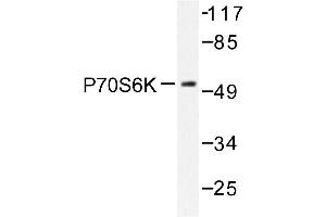 Image no. 1 for anti-Ribosomal Protein S6 Kinase, 70kDa, Polypeptide 1 (RPS6KB1) antibody (ABIN272053) (RPS6KB1 anticorps)