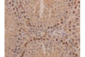 anti-Superoxide Dismutase 1, Soluble (SOD1) (AA 2-154) antibody