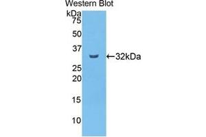Western blot analysis of the recombinant protein. (CPB2 anticorps  (AA 164-417))