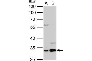 WB Image Annexin V antibody detects ANXA5 protein by Western blot analysis. (Annexin V anticorps)