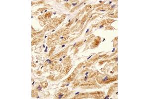 Immunohistochemical analysis of paraffin-embedded H. (ITGB8 anticorps  (AA 197-231))