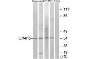 Western blot analysis of extracts from HeLa/Jurkat/HepG2/MCF-7 cells, using OR4F6 Antibody. (OR4F6 anticorps  (AA 55-104))
