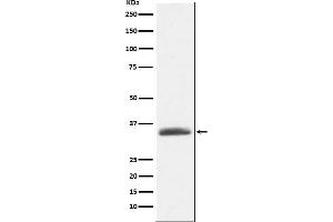 Western blot analysis of AMBP expression in human plasma lysate.