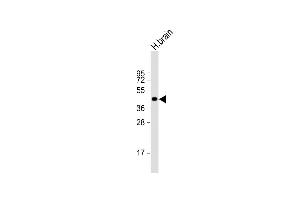 Anti-NI Antibody (N-term) at 1:1000 dilution + human brain lysate Lysates/proteins at 20 μg per lane. (NIPAL4 anticorps  (N-Term))