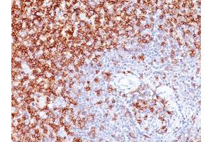 Formalin-fixed, paraffin-embedded human Tonsil stained with CD45RO Monoclonal Antibody (UCHL-1).