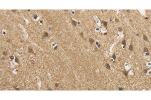 Immunohistochemistry of paraffin-embedded Human brain using GAS7 Polyclonal Antibody at dilution of 1:50 (GAS7 anticorps)
