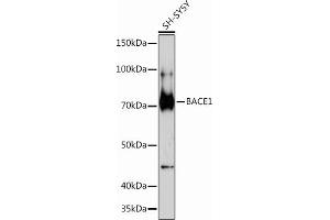 Western blot analysis of extracts of SH-SY5Y cells, using B Rabbit mAb (ABIN7265879) at 1:1000 dilution. (BACE1 anticorps)