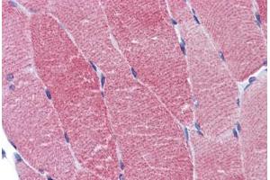 Human Skeletal Muscle: Formalin-Fixed, Paraffin-Embedded (FFPE)
