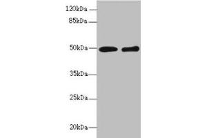 Western blot All lanes: ZBTB25 antibody at 1. (ZBTB25 anticorps  (AA 266-435))