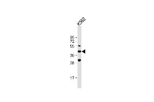 Anti-VEGF3 Antibody (N-term) at 1:1000 dilution + K562 whole cell lysate Lysates/proteins at 20 μg per lane. (VEGFC anticorps  (N-Term))