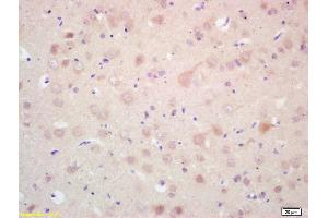 Formalin-fixed and paraffin embedded rat brain labeled with Rabbit Anti MAP LC3 Beta Polyclonal Antibody, Unconjugated (ABIN1386128) at 1:200 followed by conjugation to the secondary antibody and DAB staining (MAP1LC3A/B anticorps  (AA 25-121))