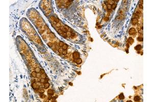ABIN6258661 and ABIN6274799 at 1/100 staining Rat stomach tissue by IHC-P. (ACSS2 anticorps  (N-Term))