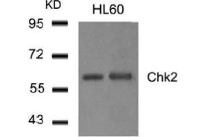 Western blot analysis of extract from HL60 cells using Chk2. (CHEK2 anticorps  (AA 514-518))