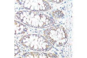 Immunohistochemistry of paraffin-embedded human colon using HSD17B10 antibody.