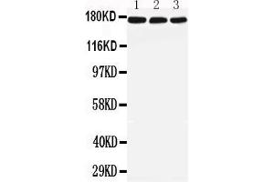 Anti-LRP5 antibody, All Western blottingAll lanes: Anti-LRP5 at 0.