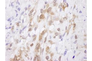 Immunohistochemistry (IHC) image for anti-Superoxide Dismutase 1, Soluble (SOD1) (AA 54-104) antibody (ABIN7453945)