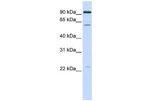 CDC45L antibody used at 1 ug/ml to detect target protein. (CDC45 anticorps)