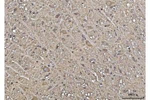 IHC analysis of YWHAE using anti-YWHAE antibody (ABIN7600163). (YWHAE anticorps  (AA 16-163))