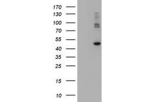 Image no. 2 for anti-Carboxypeptidase A2 (Pancreatic) (CPA2) antibody (ABIN1497595)