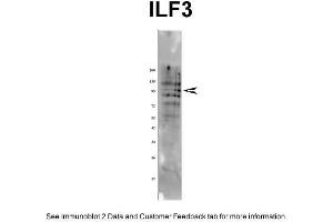 WB Suggested Anti-ILF3 Antibody    Titration:  1 ug/ml  Positive Control:  Rat tissue (Interleukin enhancer-binding factor 3 (ILF3) (N-Term) anticorps)