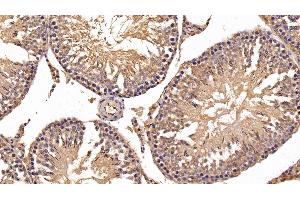 Detection of HK1 in Rat Testis Tissue using Polyclonal Antibody to Hexokinase 1 (HK1) (Hexokinase 1 anticorps  (AA 80-215))