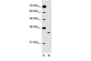 Image no. 2 for anti-Solute Carrier Family 25 (Mitochondrial Carrier: Glutamate), Member 22 (SLC25A22) (AA 131-180) antibody (ABIN205021)
