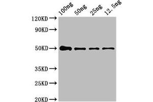 Western Blot Positive WB detected in Recombinant protein All lanes: NIPBL antibody at 4 μg/mL Secondary Goat polyclonal to rabbit IgG at 1/50000 dilution predicted band size: 50 kDa observed band size: 50 kDa