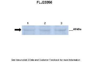 Lanes:   Lane 1: 30ug mouse renal epithelial lysate Lane 2: 30ug mouse renal epithelial lysate Lane 3: 30ug mouse renal epithelial lysate  Primary Antibody Dilution:   1:500  Secondary Antibody:   Anti-rabbit-HRP  Secondary Antibody Dilution:   1:2500  Gene Name:   FLJ23356  Submitted by:   Dr.