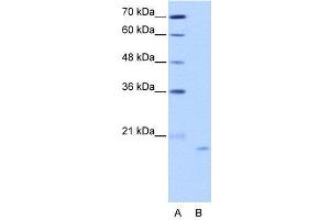 WB Suggested Anti-NOL6  Antibody Titration: 2. (Nucleolar Protein 6 anticorps  (C-Term))