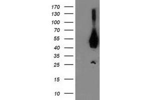 Western Blotting (WB) image for anti-Activating Signal Cointegrator 1 Complex Subunit 1 (ASCC1) antibody (ABIN1496743) (ASCC1 anticorps)
