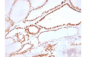 IHC: Formalin-fixed, paraffin-embedded human thyroid stained with recombinant NKX2. (NKX2-1 anticorps)