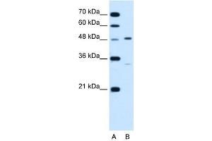 CHST1 antibody used at 1. (CHST1 anticorps)