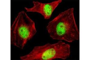 Fluorescent confocal image of HeLa cell stained with SUMO2/3 Antibody antibody at 1:25. (SUMO2/3 anticorps  (AA 53-84))