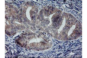 Image no. 5 for anti-Regulatory Factor X-Associated Ankyrin Containing Protein (RFXANK) antibody (ABIN1500685)