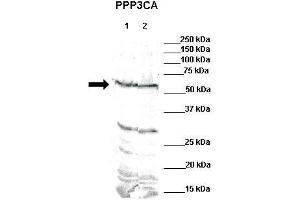 WB Suggested Anti-PPP3CA Antibody    Positive Control:  Lane 1: 80ug mouse brain extractLane 2: 80ug rat brain extract  Primary Antibody Dilution :   1:500  Secondary Antibody :  IRDye 800 CW goat anti-rabbit from Li-COR Bioscience  Secondry Antibody Dilution :   1:20,000  Submitted by:  Dr.