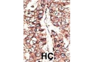 Immunohistochemistry (IHC) image for anti-Melanoma Antigen Family A, 11 (MAGEA11) antibody (ABIN3002529)